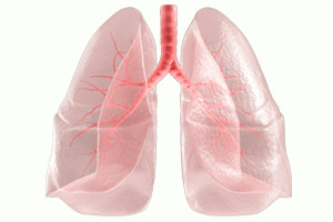 Respiratory system cancer